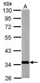 Anti-SLC25A22 antibody [N1C3] used in Western Blot (WB). GTX110700