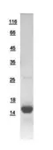 Human ATP6J protein, His tag. GTX110702-pro