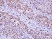 Anti-Catalase antibody used in IHC (Paraffin sections) (IHC-P). GTX110704