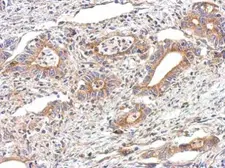 Anti-alpha Tubulin antibody used in IHC (Paraffin sections) (IHC-P). GTX110717