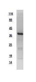 Human p38 MAPK protein, His tag. GTX110720-pro