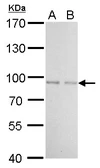 Anti-FOXO1 antibody used in Western Blot (WB). GTX110724