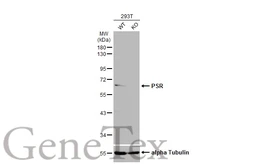 Anti-PSR antibody used in Western Blot (WB). GTX110746