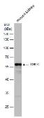 Anti-CBLC antibody [N1C2] used in Western Blot (WB). GTX110775