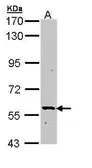 Anti-PLA2G3 antibody [C1C3] used in Western Blot (WB). GTX110780