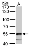 Anti-ATP6V1B2 antibody used in Western Blot (WB). GTX110783