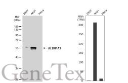 Anti-ALDH1A3 antibody [N2C2], Internal used in Western Blot (WB). GTX110784