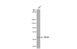 Anti-TBLR1 antibody [N3C3] used in Western Blot (WB). GTX110785