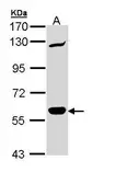 Anti-CARD9 antibody [N1N3] used in Western Blot (WB). GTX110789