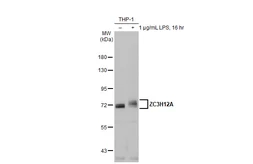 Anti-ZC3H12A antibody [N3C3] used in Western Blot (WB). GTX110807