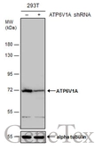 Anti-ATP6V1A antibody used in Western Blot (WB). GTX110815