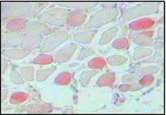 Anti-Myosin skeletal slow antibody [NOQ7.5.4D] used in IHC (Paraffin sections) (IHC-P). GTX11083