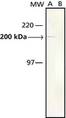 Anti-Myosin skeletal slow antibody [NOQ7.5.4D] used in Western Blot (WB). GTX11083
