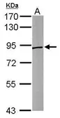 Anti-Sortilin 1 antibody [C1C3] used in Western Blot (WB). GTX110857