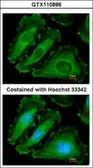 Anti-NALP2 antibody [N3C2], Internal used in Immunocytochemistry/ Immunofluorescence (ICC/IF). GTX110886