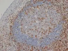 Anti-CD3 epsilon antibody [CD3-12] used in IHC (Paraffin sections) (IHC-P). GTX11089
