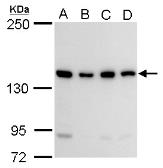 Anti-CCAR1 antibody used in Western Blot (WB). GTX110892