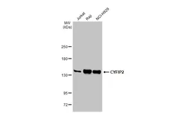Anti-CYFIP2 antibody [N2C1], Internal used in Western Blot (WB). GTX110897