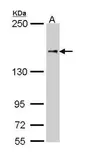 Anti-NFAT5 antibody [N1N2], N-term used in Western Blot (WB). GTX110903