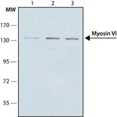 Anti-MYO6 antibody [MUD-19] used in Western Blot (WB). GTX11095
