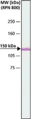 Anti-MYO6 antibody used in Western Blot (WB). GTX11096