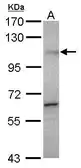 Anti-Gemin 3 antibody [N3C2], Internal used in Western Blot (WB). GTX110962