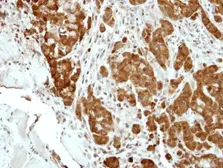 Anti-BCL2L15 antibody used in IHC (Paraffin sections) (IHC-P). GTX110988