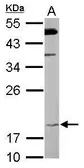 Anti-FAIM1 antibody [N1C3] used in Western Blot (WB). GTX110991