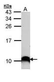 Anti-COX7B2 antibody [N1C3] used in Western Blot (WB). GTX110995
