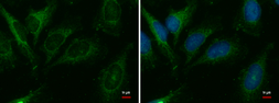 Anti-CER1 antibody used in Immunocytochemistry/ Immunofluorescence (ICC/IF). GTX111000