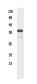 Human ATP6V0D2 protein, His tag. GTX111006-pro