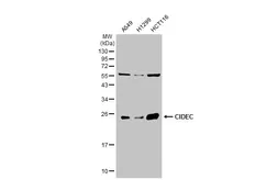 Anti-CIDEC antibody [N1C3] used in Western Blot (WB). GTX111008