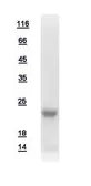 Human HBXIP protein, His tag. GTX111009-pro