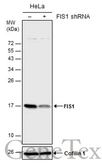 Anti-FIS1 antibody used in Western Blot (WB). GTX111010
