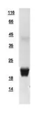 Human EIF5A protein, His tag. GTX111013-pro