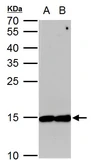 Anti-EIF5A antibody used in Western Blot (WB). GTX111013