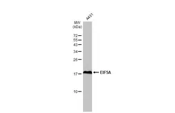 Anti-EIF5A antibody used in Western Blot (WB). GTX111013