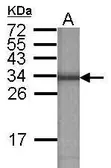 Anti-ATP6V1E2 antibody [N1C3] used in Western Blot (WB). GTX111015