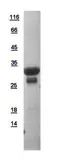 Human V-ATPase D protein, His tag. GTX111025-pro