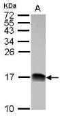 Anti-NDUFB4 antibody used in Western Blot (WB). GTX111026