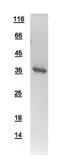 Human ATP6V0D1 protein, His tag. GTX111027-pro