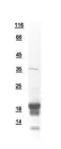 Human NUDT2 protein, His tag. GTX111037-pro