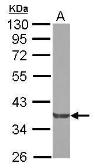 Anti-Nck beta antibody [N1C2] used in Western Blot (WB). GTX111040
