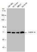 Anti-HSP70 1L antibody [N1N3] used in Western Blot (WB). GTX111045