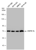 Anti-HSP70 1L antibody [N1N3] used in Western Blot (WB). GTX111045
