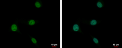 Anti-PLZF antibody [N1N3] used in Immunocytochemistry/ Immunofluorescence (ICC/IF). GTX111046