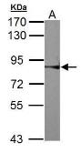 Anti-RSK2 antibody used in Western Blot (WB). GTX111049