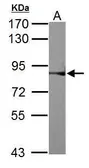 Anti-RSK2 antibody used in Western Blot (WB). GTX111049