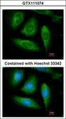 Anti-RIP antibody used in Immunocytochemistry/ Immunofluorescence (ICC/IF). GTX111074