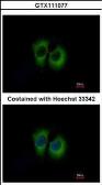 Anti-TID1 antibody [N3C3] used in Immunocytochemistry/ Immunofluorescence (ICC/IF). GTX111077